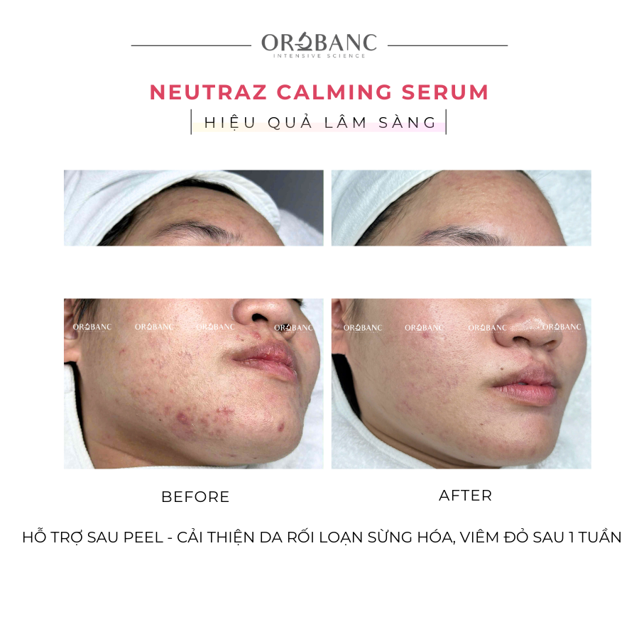 web_TotalStrengthSerum_10ml_1200x1200